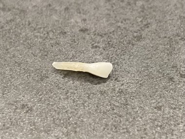 ビションフリーゼ おもち 抜けた歯が出てきました(笑) IMG_2199-380x285 ビションフリーゼ おもち 抜けた歯が出てきました(笑) IMG_2199-380x285